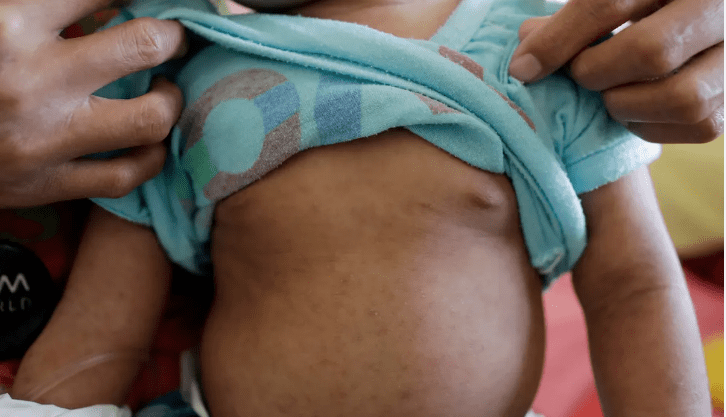 over-5.3m-under-5-children-to-be-immunised-against-measles-rubella-from-october